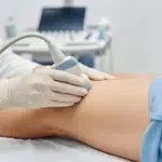 Close-up of a doctor using an ultrasound probe on a patient's leg to assess blood flow and check for vein issues (vascular ultrasound).
